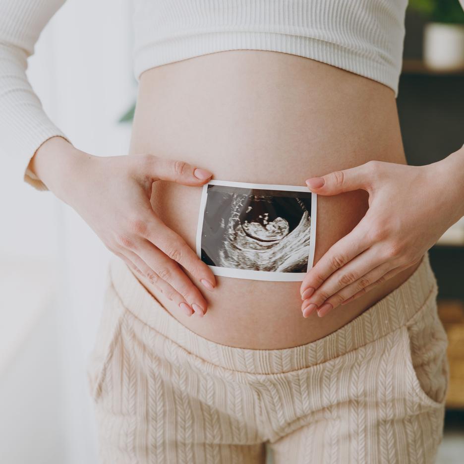 VERACITY 13,18,21; obecność i aneuploidie chromosomów płci, mikrodelecje