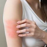 Pakiet badań - alergiczny atopowy (20 alergenów)